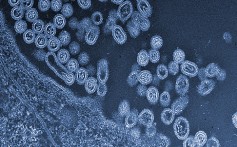 Infectious particles of the avian H7N9 virus emerging from a cell, in this image provided by <i>Science</i> and the University of Tokyo. Photo: AP
