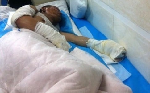 A person wounded in the blasts receiving treatment at a Changchun hospital earlier on Monday. Photo: Screenshot from Sina Weibo