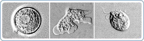 Microscopic images show theNaegleria fowleri amoeba in different forms of existence: a cyst stage (left), trophozoite stage (centre) and full-size "flagellated" stage. Photo: AP