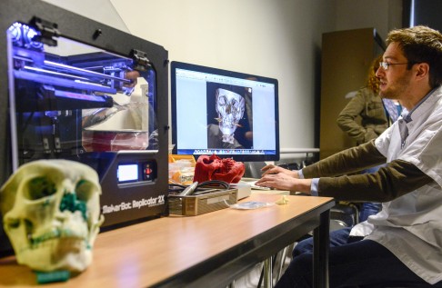 A 3D printer is used to reproduce the skull of a patient in the University Hospital of Dijon, France. 3D printing can perform such tasks much more cheaply than traditional methods. Photo: AFP