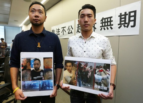 Ken Tsang Kin-chiu (left) and Osman Cheng Chung-hang show pictures of their injuries allegedly inflicted by police. Photo: Jonathan Wong