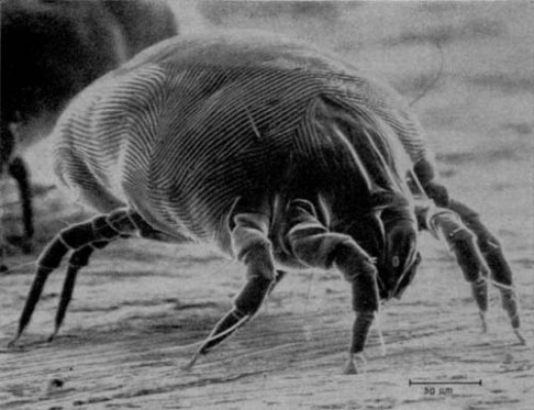An average of 6.3 mites per gram were detected in dust from mattresses, with the most extreme sample containing 46 mites per gram.