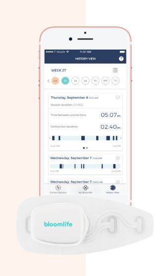 Bloomlife keeps track of contractions and helps take the guesswork out