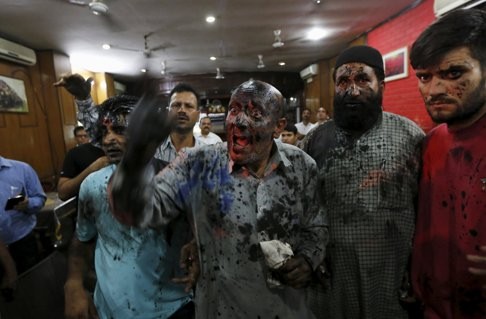 A Kashmiri lawmaker was smeared with oil and ink by activists from a Hindu hardline group last month, after he opposed the ban on eating beef. Photo: Reuters