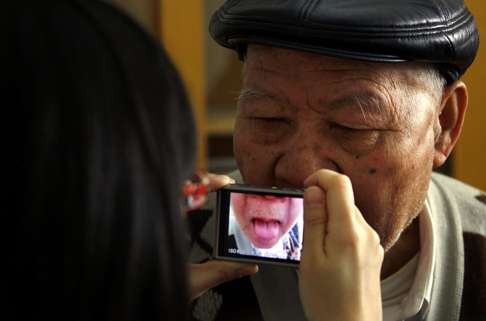 A diabetes patient has his tongue photographed for the record before seeing a specialist doctor in Beijing. Photo: Reuters