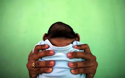 The Zika virus can cause severe brain damage to unborn babies. Photo: Reuters