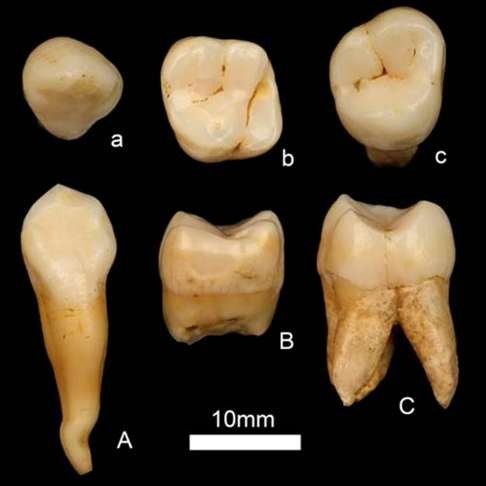 Three ancient human teeth more than 100,000 years old discovered by a team of researchers led by professor Zhao Lingxia in Bijie, Guizhou. Photo: Institute of Vertebrate Palaeontology and Palaeoanthropology, Chinese Academy of Sciences