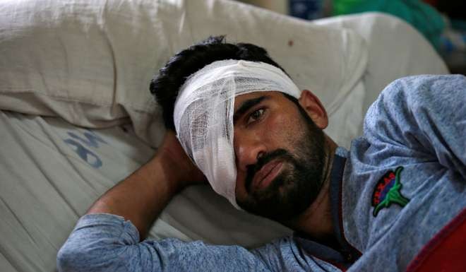 A man who was injured in clashes between Indian police and protesters, rests inside a hospital ward in Srinagar. Photo: Reuters