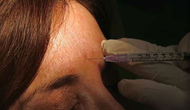 A surgeon injects Botox into the forehead of a woman. Beauty salon workers argue that since anyone adroit with a needle can safely administer Botox, why should medical doctors be the only people allowed to make a living from it? Photo: Reuters