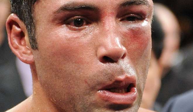 Oscar De La Hoya looks on after his welterweight boxing match against WBC lightweight champion Manny Pacquiao in Las Vegas in 2008. Photo: AP